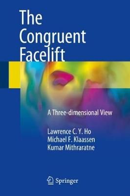 The Congruent Facelift 9783319690896 (Hardback)