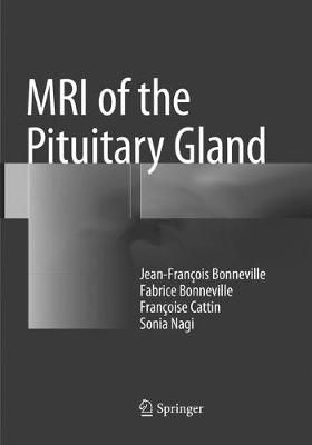 MRI of the Pituitary Gland 9783319804798 (Paperback)
