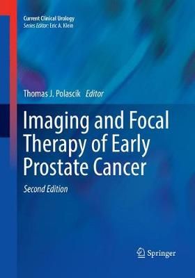 Imaging and Focal Therapy of Early Prostate Cancer 9783319842714