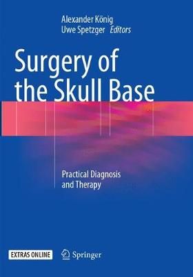Surgery of the Skull Base 9783319877013 (Paperback)