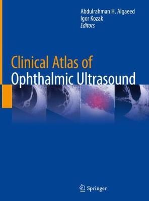 Clinical Atlas of Ophthalmic Ultrasound 9783319998695 (Hardback)