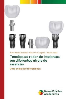 Tensoes ao redor de implantes em diferentes niveis de insercao