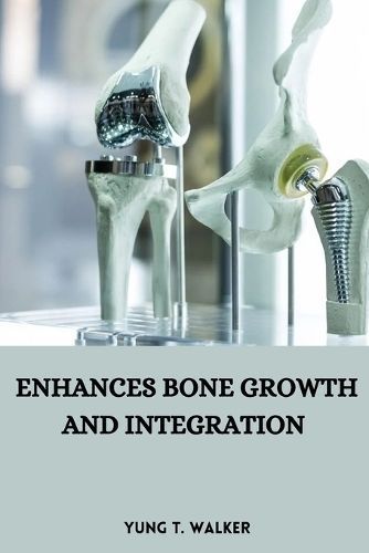 Enhances bone growth and integration By T Walker 9783373432531