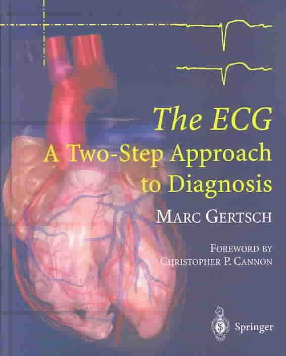 The ECG By Marc Gertsch 9783540008699 (Hardback)