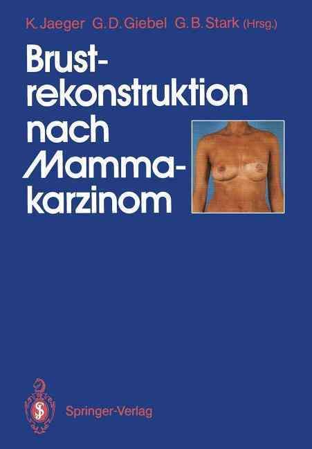 Brustrekonstruktion Nach Mammakarzinom 9783540519607 (Paperback)