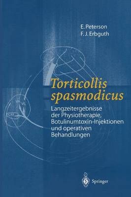 Torticollis Spasmodicus By E. Peterson, F.J. Erbguth 9783540674481