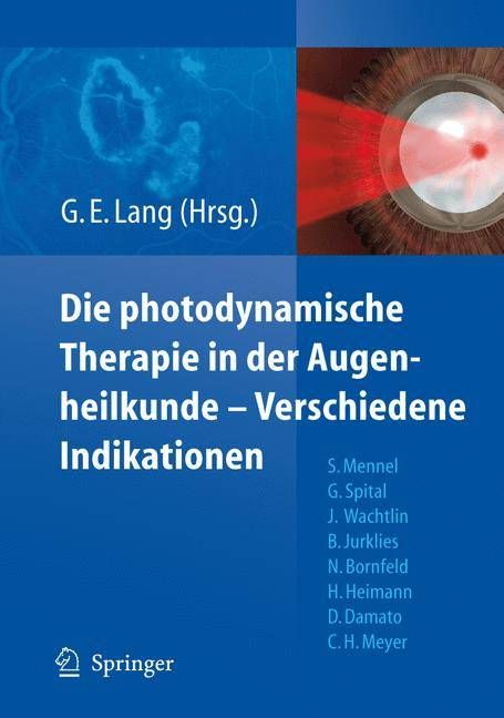 Die Photodynamische Therapie in Der Augenheilkunde - Verschiedene Indikationen