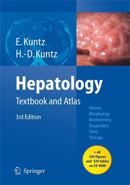 Hepatology By Erwin Kuntz, Hans-Dieter Kuntz 9783540768388 (Hardback)