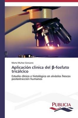Aplicacion clinica del β-fosfato tricalcico 9783639559460