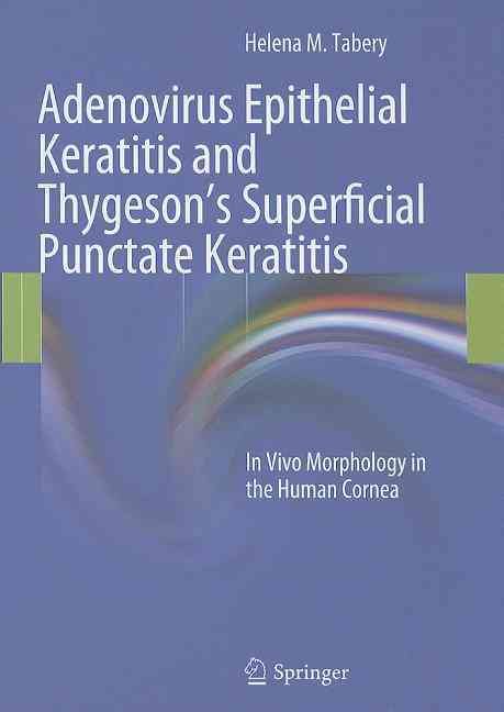 Adenovirus Epithelial Keratitis and Thygeson's Superficial Punctate Keratitis