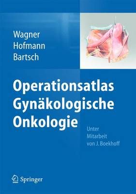 Operationsatlas Gynäkologische Onkologie 9783642351273 (Hardback)