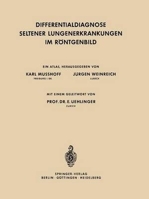 Differentialdiagnose Seltener Lungenerkrankungen Im Röntgenbild
