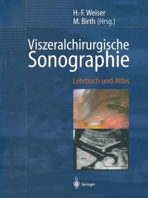 Viszeralchirurgische Sonographie 9783642629587 (Paperback)