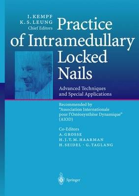 Practice of Intramedullary Locked Nails By I. Kempf 9783642629624