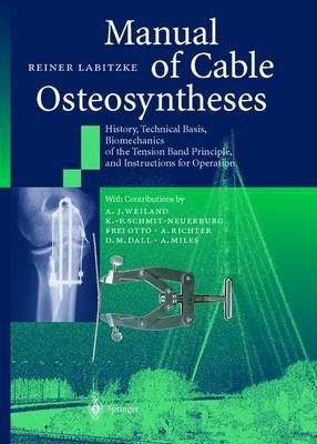Manual of Cable Osteosyntheses 9783642630590 (Paperback)