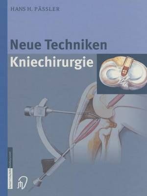 Neue Techniken Kniechirurgie 9783642632839 (Paperback)