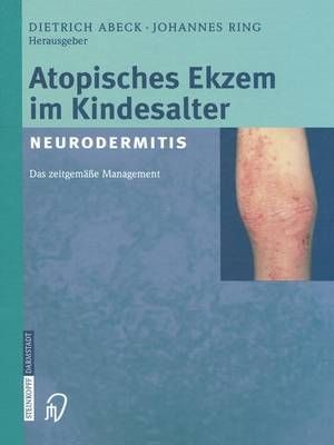 Atopisches Ekzem Im Kindesalter (Neurodermitis) 9783642632945