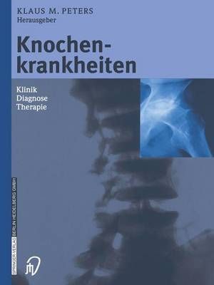 Knochenkrankheiten: Klinik Diagnose Therapie By Peters, Klaus M.