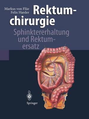 Rektumchirurgie 9783642644443 (Paperback)