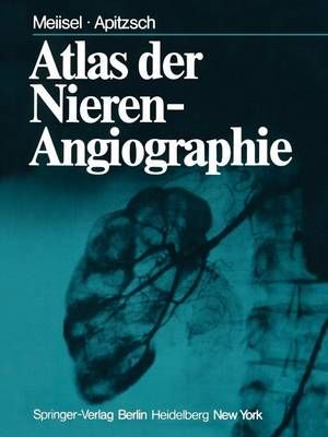 Atlas Der Nierenangiographie 9783642667909 (Paperback)
