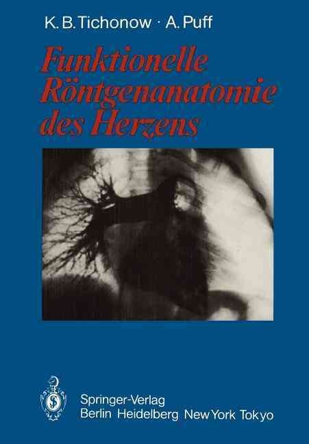 Funktionelle Röntgenanatomie Des Herzens 9783642704482 (Paperback)
