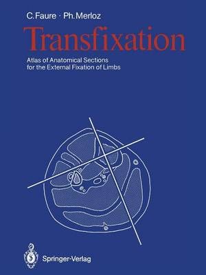 Transfixation 9783642716218 (Paperback)