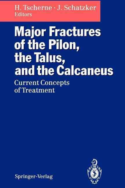 Major Fractures of the Pilon, the Talus, and the Calcaneus (Paperback)
