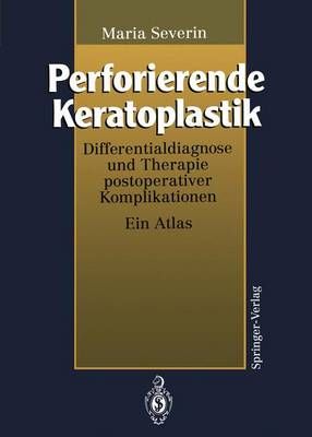 Perforierende Keratoplastik By Maria Severin 9783642790072 (Paperback)
