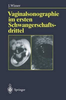 Vaginalsonographie Im Ersten Schwangerschaftsdrittel By Josef Wisser