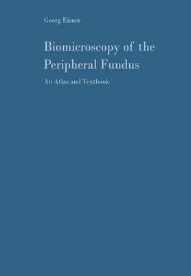 Biomicroscopy of the Peripheral Fundus 9783642858055 (Paperback)