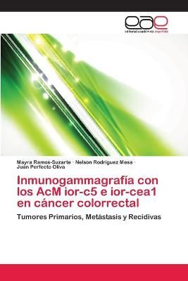 Inmunogammagrafia con los AcM ior-c5 e ior-cea1 en cancer colorrectal