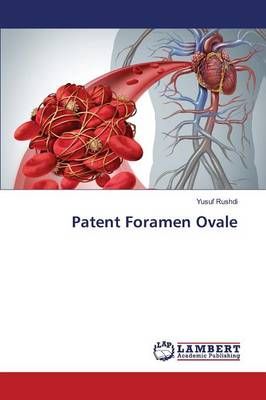 Patent Foramen Ovale By Rushdi Yusuf 9783659832697 (Paperback)