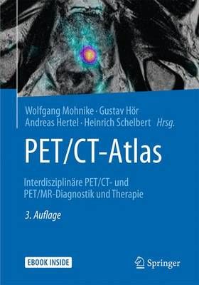 PET/CT-Atlas By Wolfgang Mohnike 9783662488416 (Mixed media product)