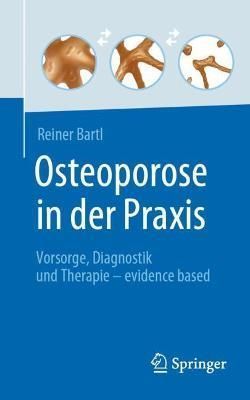 Osteoporose in Der Praxis By Reiner Bartl 9783662642061 (Paperback)