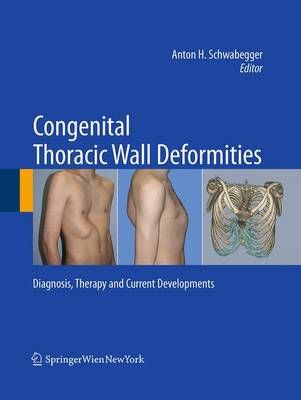 Congenital Thoracic Wall Deformities By Anton H. Schwabegger (editor)