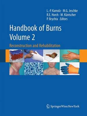 Handbook of Burns Volume 2 9783709119211 (Paperback)