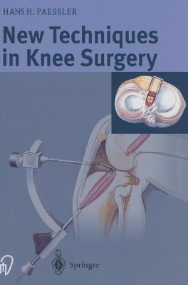 New Techniques in Knee Surgery 9783798513877 (Hardback)