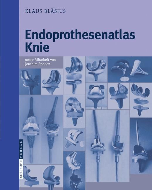 Endoprothesenatlas Knie 9783798517660 (Paperback)