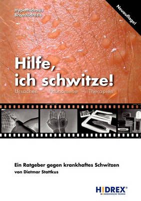 Hilfe, ich schwitze! By Stattkus, Dietmar 9783898112673 (Paperback)