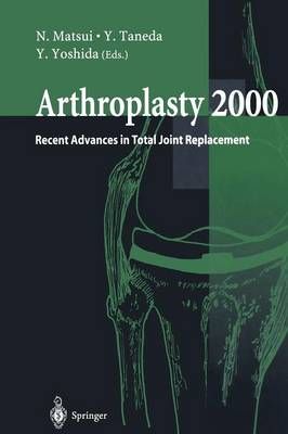 Arthroplasty 2000 9784431684299 (Paperback)