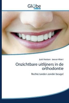 Onzichtbare uitlijners in de orthodontie By Madaan 9786139419623