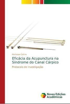 Eficácia da Acupunctura na Síndrome do Canal Cárpico By Cotrim