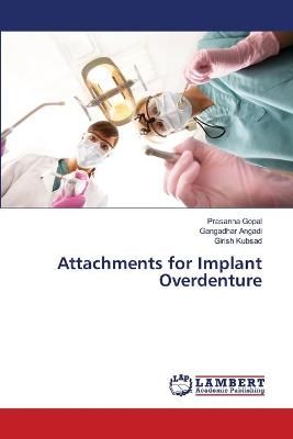 Attachments for Implant Overdenture By Prasanna Gopal 9786139853588