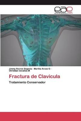 Fractura de Clavicula By Barros Segovia 9786200396693 (Paperback)