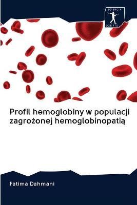 Profil hemoglobiny w populacji zagro?onej hemoglobinopati? By Dahmani