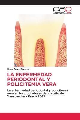 Enfermedad Periodontal Y Policitemia Vera By Salazar 9786202105248