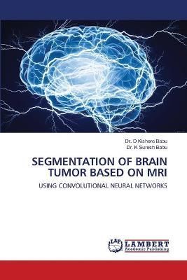 Segmentation of Brain Tumor Based on MRI By Babu 9786202557467