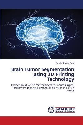 Brain Tumor Segmentation using 3D Printing Technology By Sudha Rani