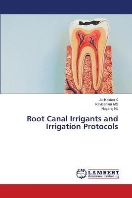 Root Canal Irrigants and Irrigation Protocols By K 9786203464948
