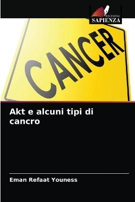 Akt e alcuni tipi di cancro By Youness 9786203482508 (Paperback)